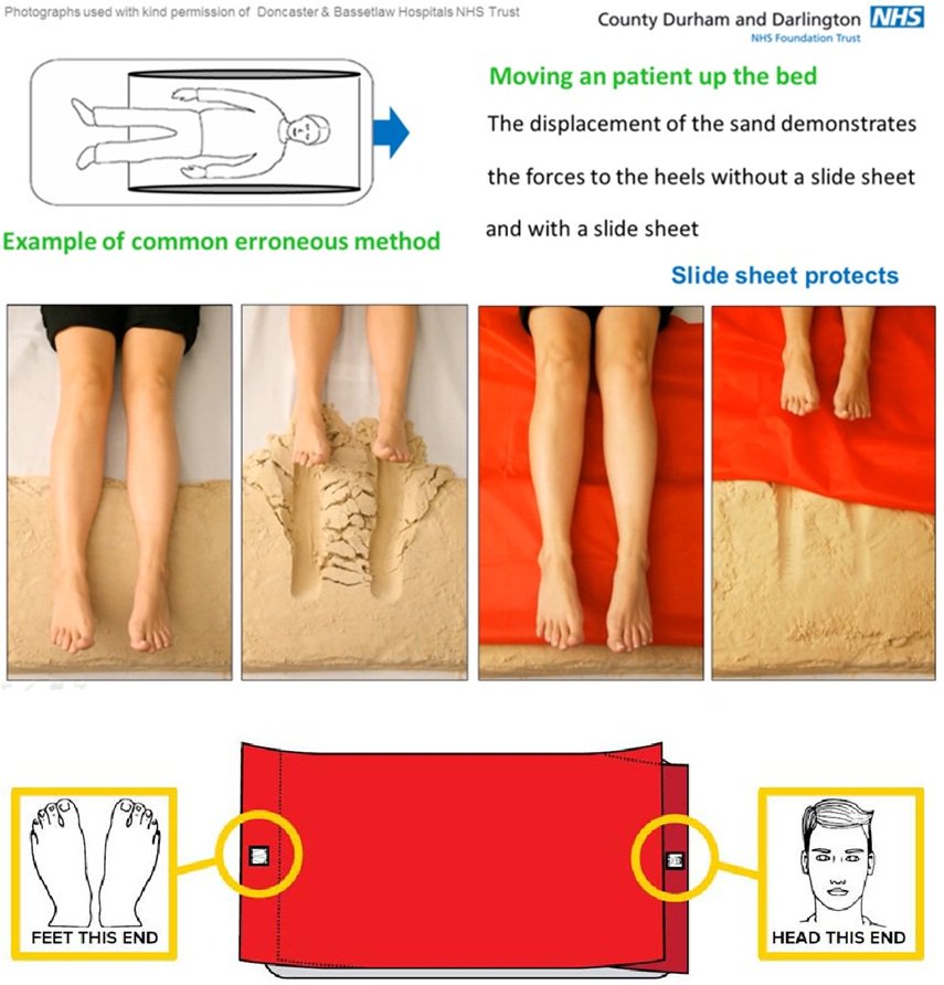 Innovative nurse reduces user error & protects patients from harm with Slide sheet design featured image